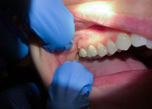 Best Emergency Treatment for Jaw Pain or Injury in Saticoy, CA