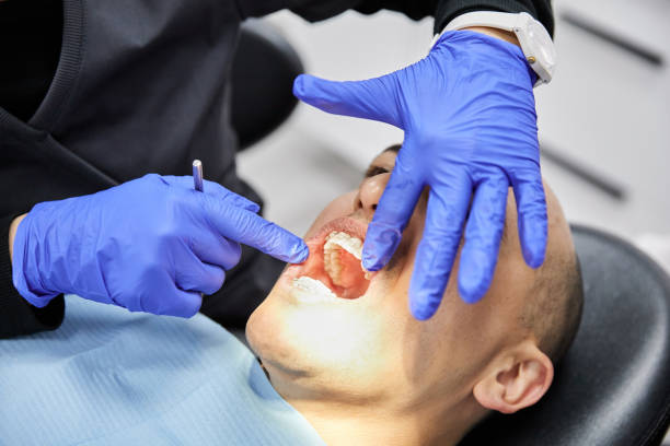 Best Knocked-Out Tooth (Avulsed Tooth) Treatment in Saticoy, CA